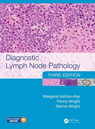 [095c7] @F.u.l.l.# ~D.o.w.n.l.o.a.d! Diagnostic Lymph Node Pathology, Third Edition - Margaret Ashton-Key *P.D.F*